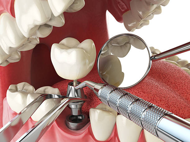 Best Broken or Cracked Tooth Emergency Dentist in Vega, TX
